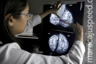 Pesquisa brasileira pode aumentar longevidade de pacientes com câncer de pulmão Pesquisa brasileira pode aumentar longevidade de pacientes com câncer de pulmão