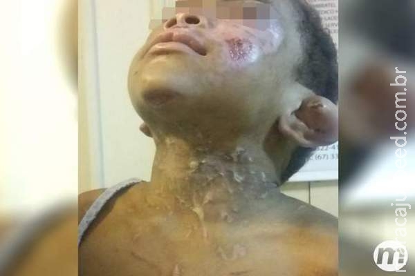 Menino torturado em rituais de magia está com família provisória fora de MS Menino torturado em rituais de magia está com família provisória fora de MS