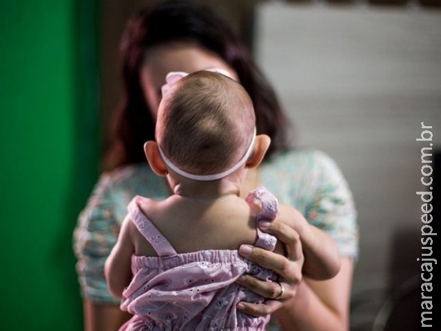 Estudo sobre zika pode levar Brasil a mudar protocolo de microcefalia Estudo sobre zika pode levar Brasil a mudar protocolo de microcefalia