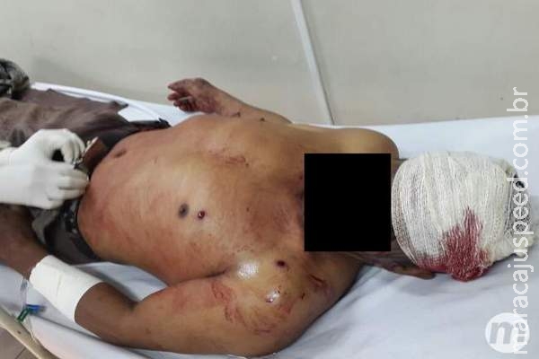 Fotos de feridos confirmam tiros em confronto entre índios e fazendeiros