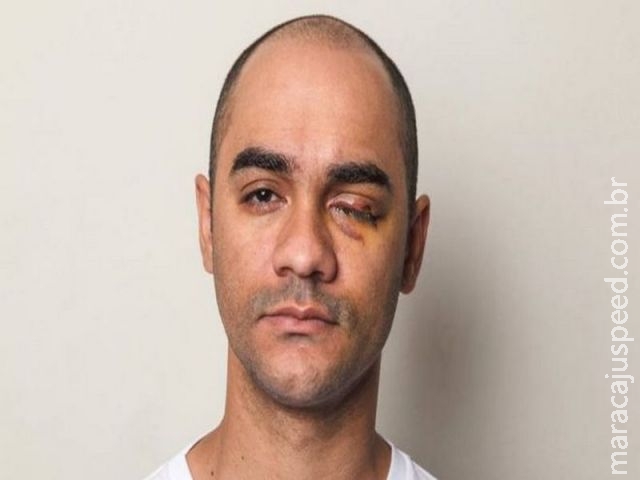 " Estado fugiu de sua responsabilidade " : a indignação do fotógrafo considerado culpado por tiro de PM que o cegou " Estado fugiu de sua responsabilidade " : a indignação do fotógrafo considerado culpado por tiro de PM que o cegou