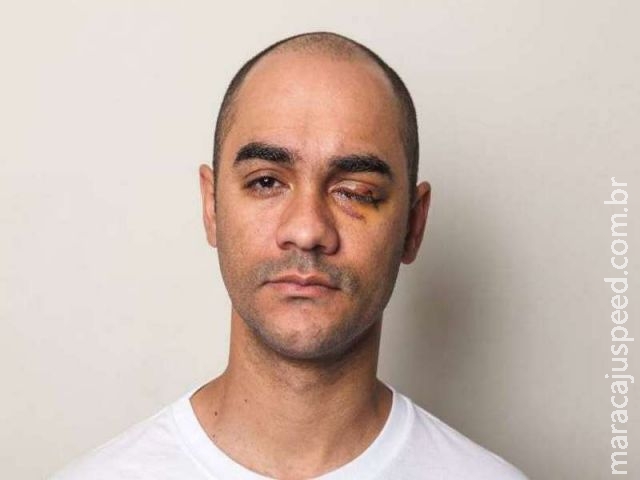 Justiça decide: Fotógrafo que perdeu visão por bala de borracha da PM em 2013 é culpado Justiça decide: Fotógrafo que perdeu visão por bala de borracha da PM em 2013 é culpado