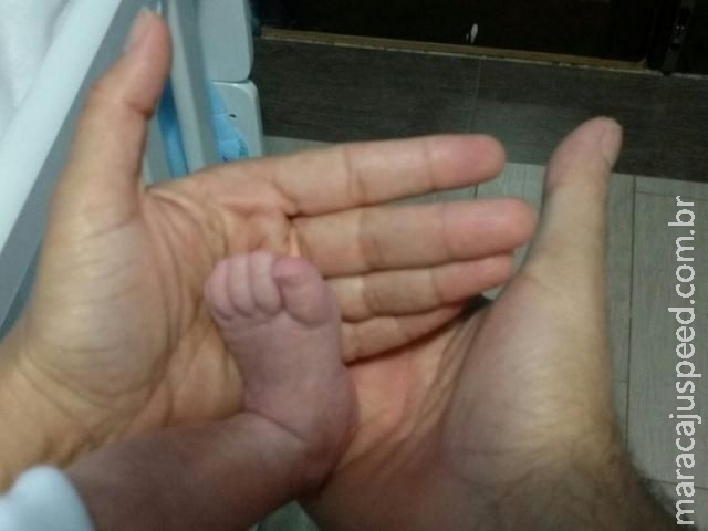 A espera de um filho, sem limitar o amor, casal adota bebê com microcefalia A espera de um filho, sem limitar o amor, casal adota bebê com microcefalia