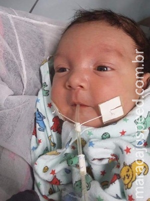 Bebê depende de transplante de cinco órgãos e US$ 1 milhão para viver Bebê depende de transplante de cinco órgãos e US$ 1 milhão para viver
