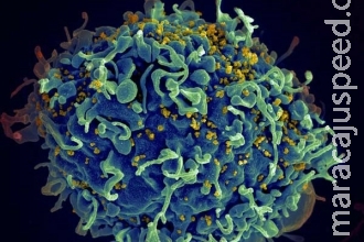 Pesquisadores desenvolvem estratégia para impedir reprodução do HIV