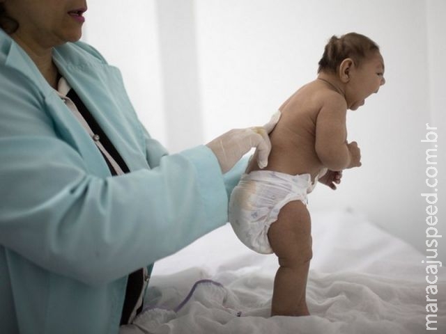 Novo estudo anglo-brasileiro reforça relação entre Zika e microcefalia Novo estudo anglo-brasileiro reforça relação entre Zika e microcefalia