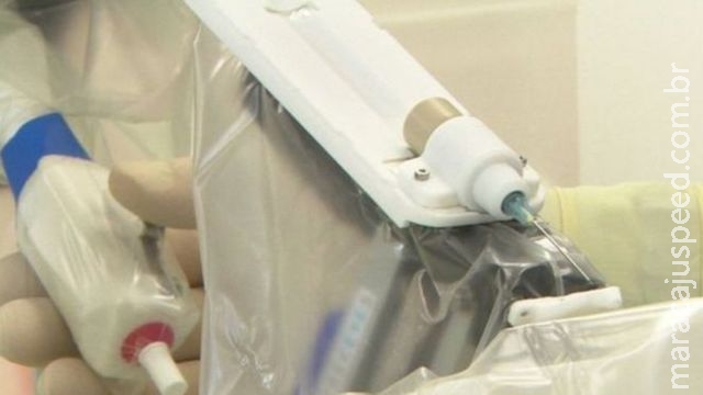 Robô realiza a primeira cirurgia intraocular para restaurar visão