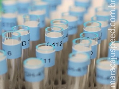 Câmara aprova projeto que prevê alerta sobre doping em medicamentos Câmara aprova projeto que prevê alerta sobre doping em medicamentos