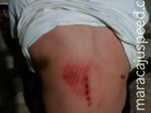 Pai disse que bateu porque criança não quer estudar e fica na rua até tarde