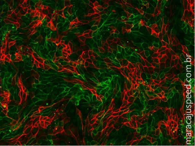 Cientistas lançam projeto para mapear todas as células humanas Cientistas lançam projeto para mapear todas as células humanas