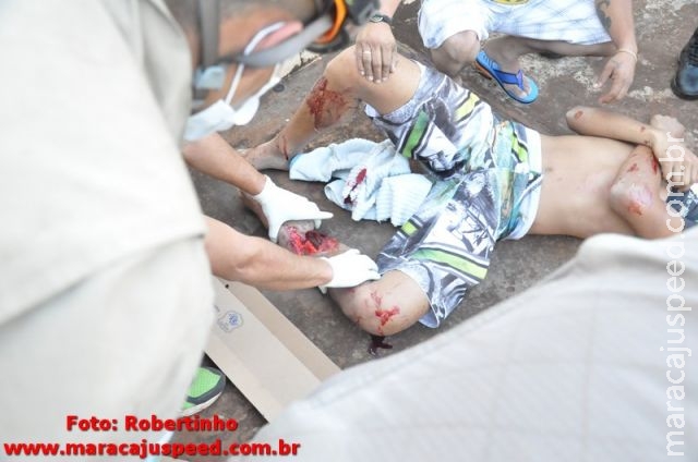 Maracaju: Colisão entre motocicleta e caminhonete deixa vítima com perna gravemente fraturada Maracaju: Colisão entre motocicleta e caminhonete deixa vítima com perna gravemente fraturada