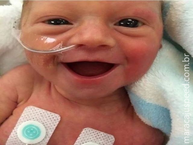 Mãe publica sorriso da filha ao nascer prematura e foto viraliza Mãe publica sorriso da filha ao nascer prematura e foto viraliza