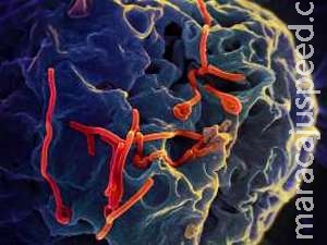 Homem britânico pode ser a primeira pessoa curada do HIV com remédios Homem britânico pode ser a primeira pessoa curada do HIV com remédios