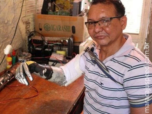 A incrível história do amputado por choque que construiu braço com sucata A incrível história do amputado por choque que construiu braço com sucata