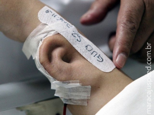 Chinês que perdeu orelha recebe órgão temporariamente no braço Chinês que perdeu orelha recebe órgão temporariamente no braço