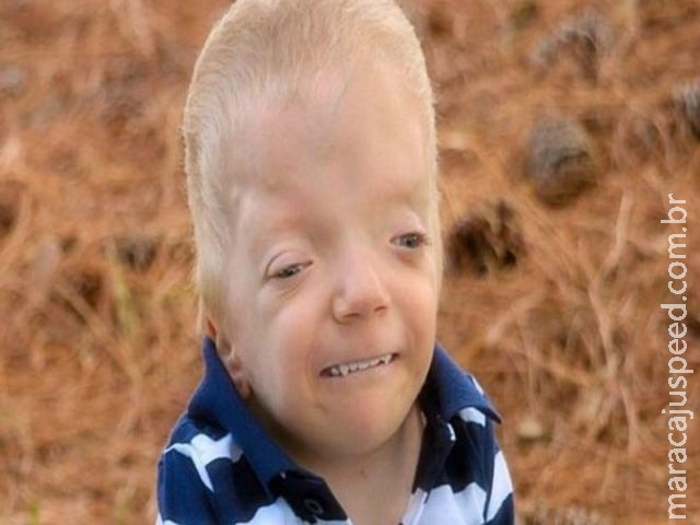 A mãe que luta contra memes que usam fotos de seu filho de 3 anos com doença terminal A mãe que luta contra memes que usam fotos de seu filho de 3 anos com doença terminal