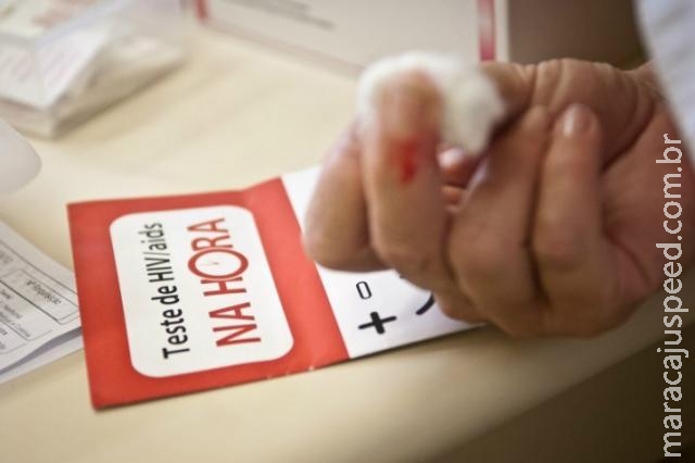 Taxa de mortalidade por Aids tem queda de 42% Taxa de mortalidade por Aids tem queda de 42%