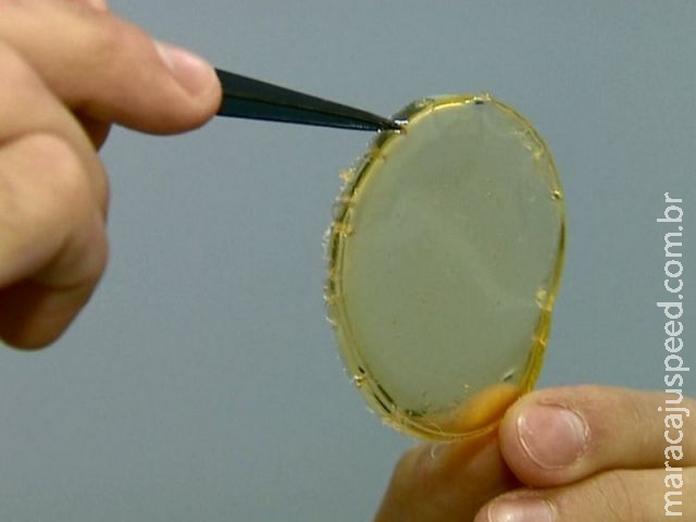 Grupo une látex e barbatimão e cria membrana cicatrizante de R$ 0,20 Grupo une látex e barbatimão e cria membrana cicatrizante de R$ 0,20
