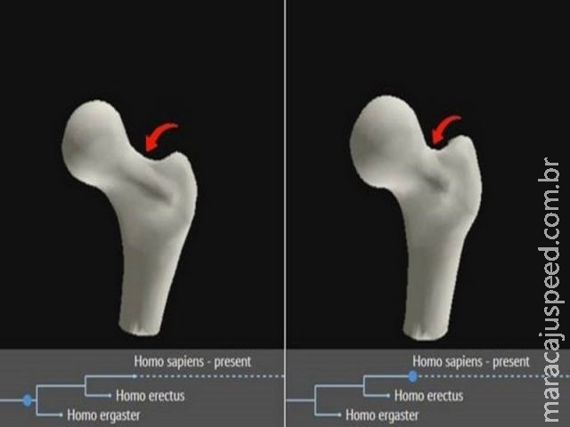  Dor no quadril e nos joelhos pode ser "ressaca da evolução ", indica estudo