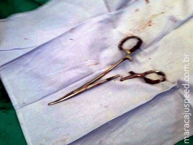 Vietnamita é operado para retirar " tesoura " esquecida em cirurgia há 18 anos Vietnamita é operado para retirar " tesoura " esquecida em cirurgia há 18 anos