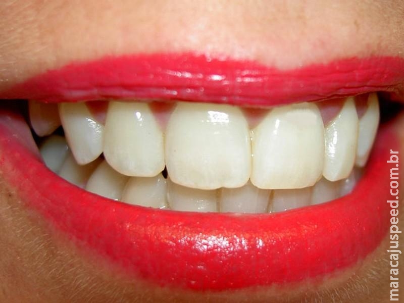 Cientistas britânicos criam substância que pode regenerar dentes e aposentar obturações Cientistas britânicos criam substância que pode regenerar dentes e aposentar obturações