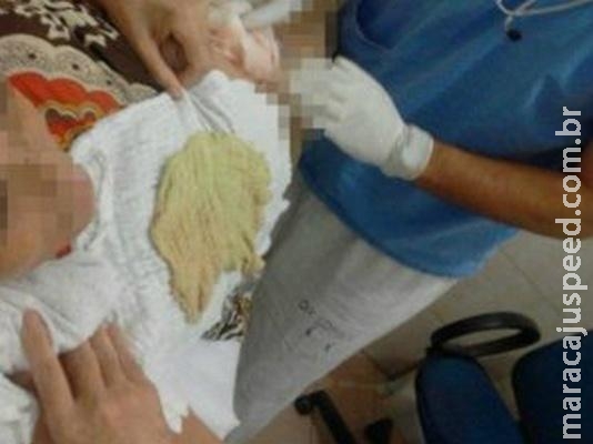 Mulher tem compressa cirúrgica esquecida dentro do abdômen Mulher tem compressa cirúrgica esquecida dentro do abdômen