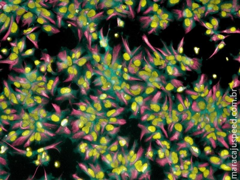 Pesquisadores identificam mais de 500 proteínas modificadas devido ao zika Pesquisadores identificam mais de 500 proteínas modificadas devido ao zika