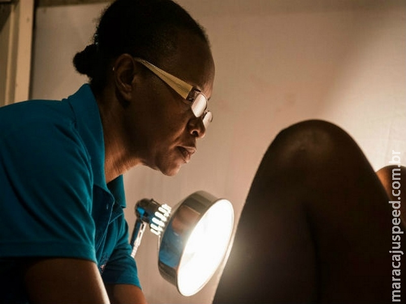 Ampliar acesso à vacina de HPV é chave para prevenir câncer cervical Ampliar acesso à vacina de HPV é chave para prevenir câncer cervical