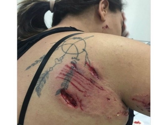 Dono de pit bull que atacou estudante em MS diz que essa foi a 1ª vez