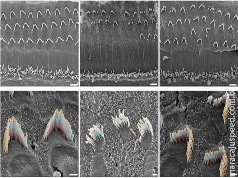 Teste com terapia genética restaura audição em ratos surdos Teste com terapia genética restaura audição em ratos surdos
