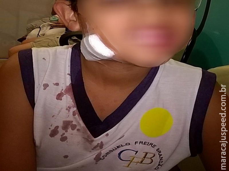 Criança de 10 anos é ferida com lâmina no pescoço por colega e escola não aciona socorro Criança de 10 anos é ferida com lâmina no pescoço por colega e escola não aciona socorro