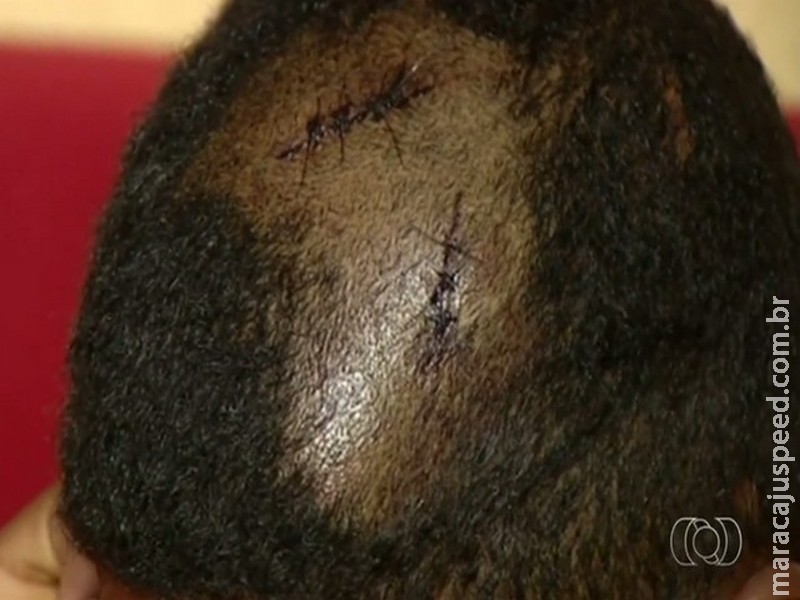 Estudante diz que foi agredido por dono de abrigo Estudante diz que foi agredido por dono de abrigo