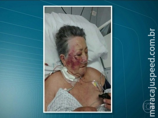Idosa é agredida por enfermeiro na UTI Idosa é agredida por enfermeiro na UTI
