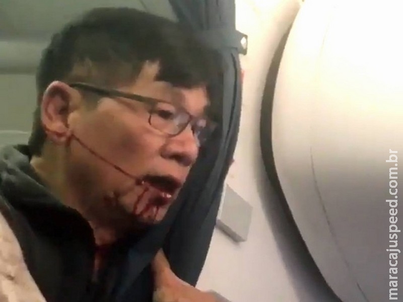 Passageiro arrancado de voo da United inicia ação legal