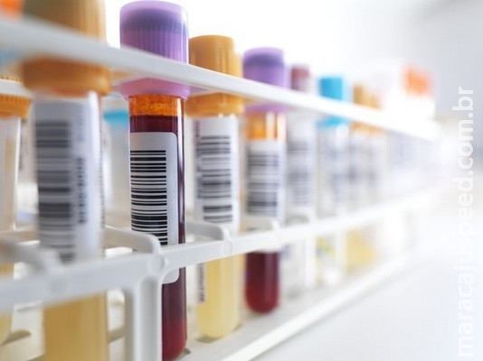 Exame de sangue detecta ressurgimento de câncer com 1 ano de antecedência Exame de sangue detecta ressurgimento de câncer com 1 ano de antecedência