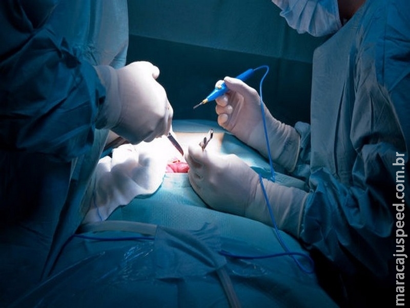 Hospital Universitário faz mutirão para reduzir fila por cirurgia vascular Hospital Universitário faz mutirão para reduzir fila por cirurgia vascular