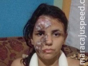 Marido procura condutor de carro que passou por cima de mulher e fugiu