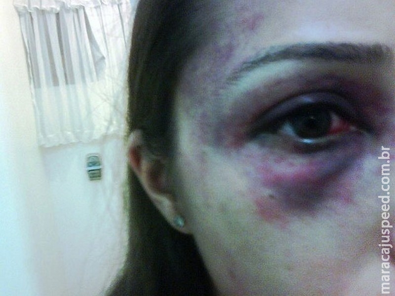 Justiça determina prisão domiciliar de empresário que agrediu a ex Justiça determina prisão domiciliar de empresário que agrediu a ex