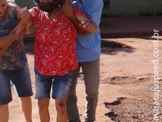 Motociclista que caiu ao passar em buraco morre após 19 dias internada Motociclista que caiu ao passar em buraco morre após 19 dias internada
