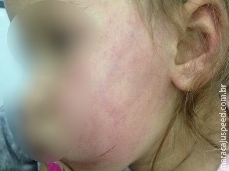 Madrasta confessa que agrediu enteada de 2 anos durante festa de família, diz polícia