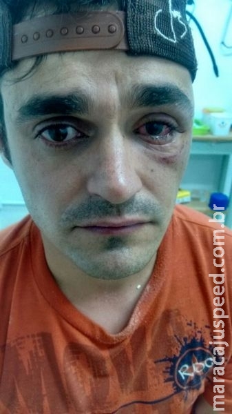 Motociclista é atingido por ovo na rua e corre o risco de perder visão Motociclista é atingido por ovo na rua e corre o risco de perder visão