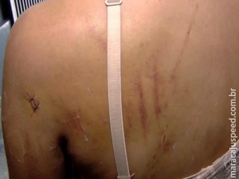 Mãe de menina torturada se revolta com soltura de menores agressoras