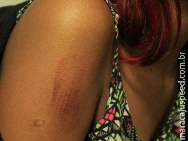 Dupla quebra portão, invade casa e fere adolescente a pedradas