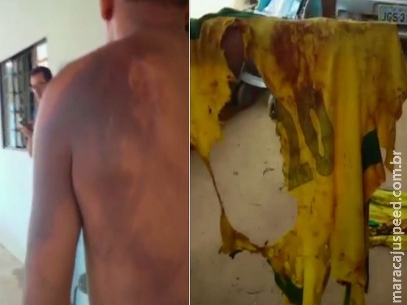 Eletricista sobrevive após ser atingido por raio enquanto jogava futebol Eletricista sobrevive após ser atingido por raio enquanto jogava futebol