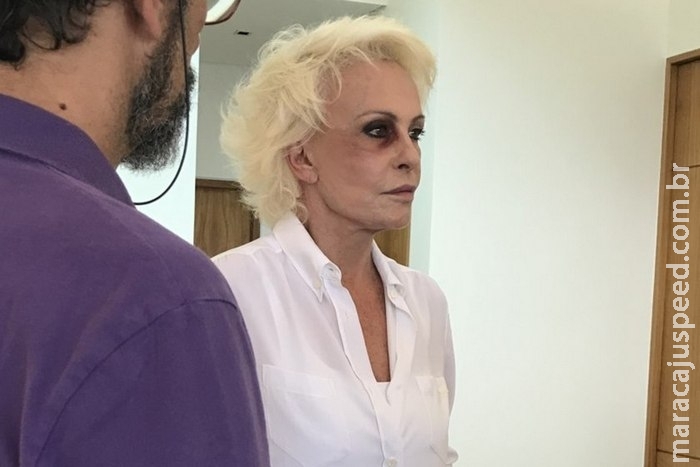 Ana Maria Braga aparece de olho roxo em foto e deixa fãs preocupados Ana Maria Braga aparece de olho roxo em foto e deixa fãs preocupados