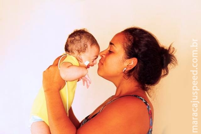 Com síndrome rara, bebê de Campo Grande precisa de R$ 10 mil para cirurgia