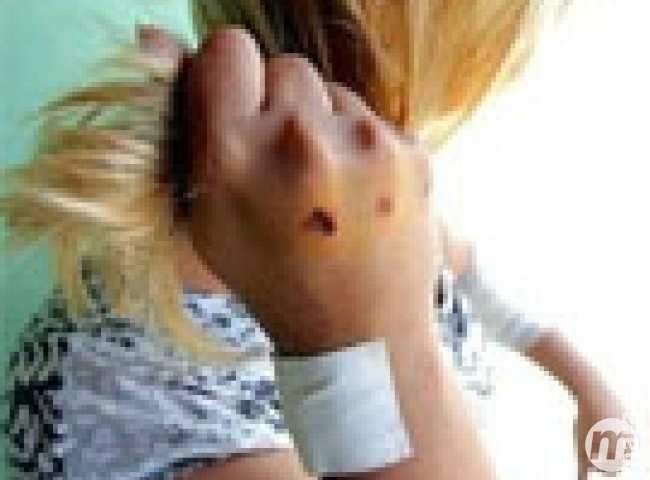 Ex invade apartamento, arranca pedaço de cabelo e dá chutes em jovem