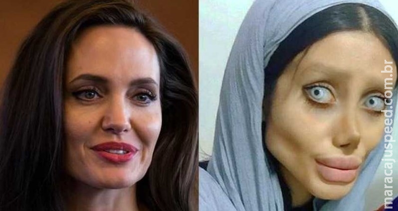 Mulher se submete a mais de 50 cirurgias plásticas para se parecer com Angelina Jolie Mulher se submete a mais de 50 cirurgias plásticas para se parecer com Angelina Jolie