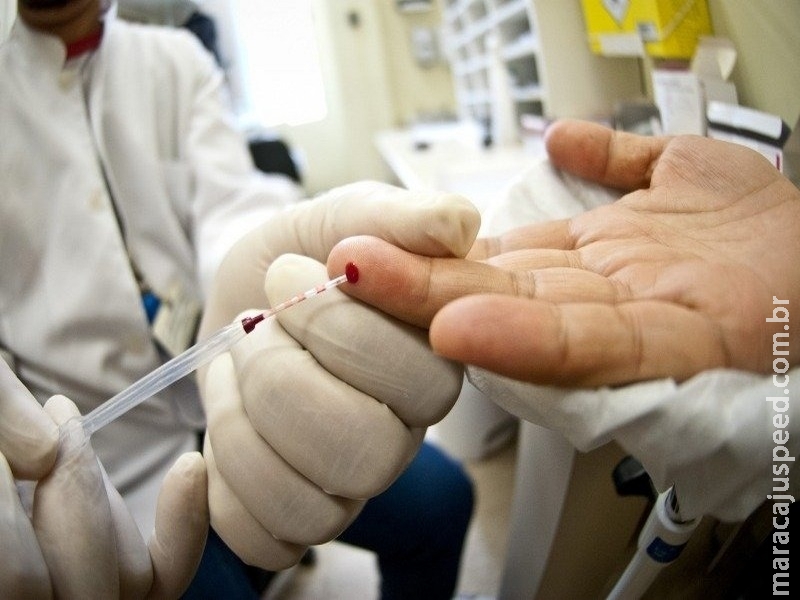 Teste rápido de HIV: onde fazer e como funciona Teste rápido de HIV: onde fazer e como funciona