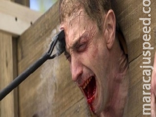 Campo Grande: Mulher é ferida no seio com ferro quente, como se marcasse gado, por mulher enciumada